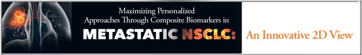 ON_150L_banner