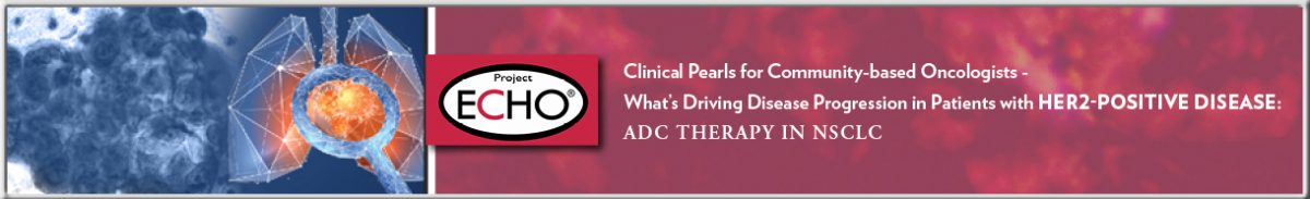 ON_195L_banner_rev (1)