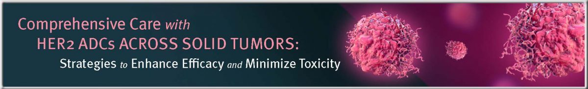 ON_313_banner_footer_Page_1